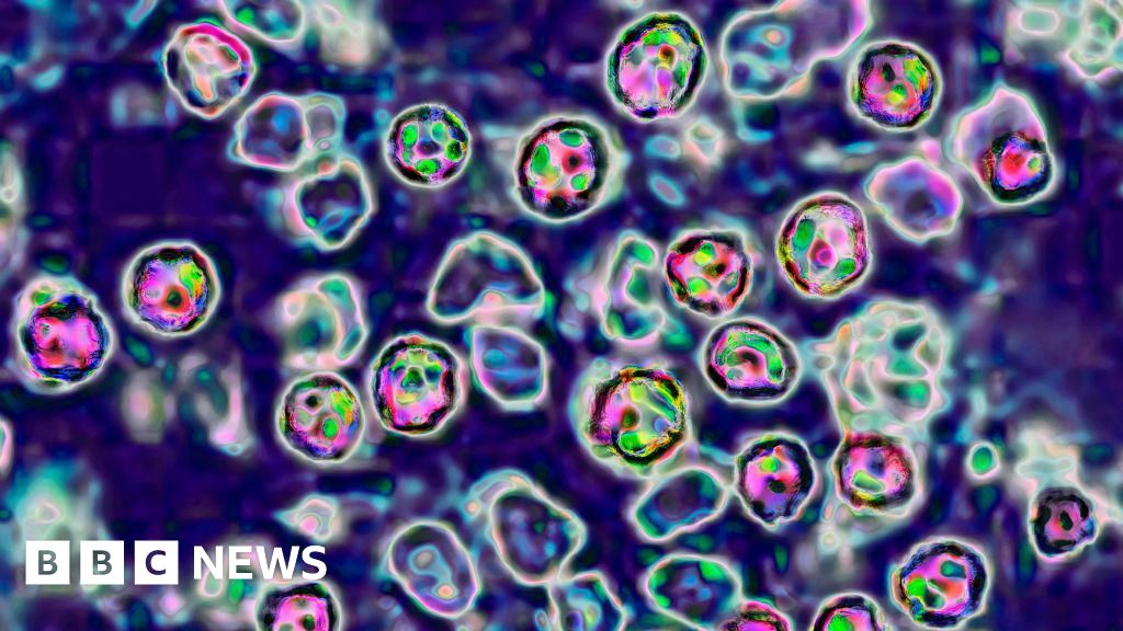 Épidémie - Épidémie de rougeole aux États-Unis : près de 100 personnes malades au Texas et au Nouveau-Mexique