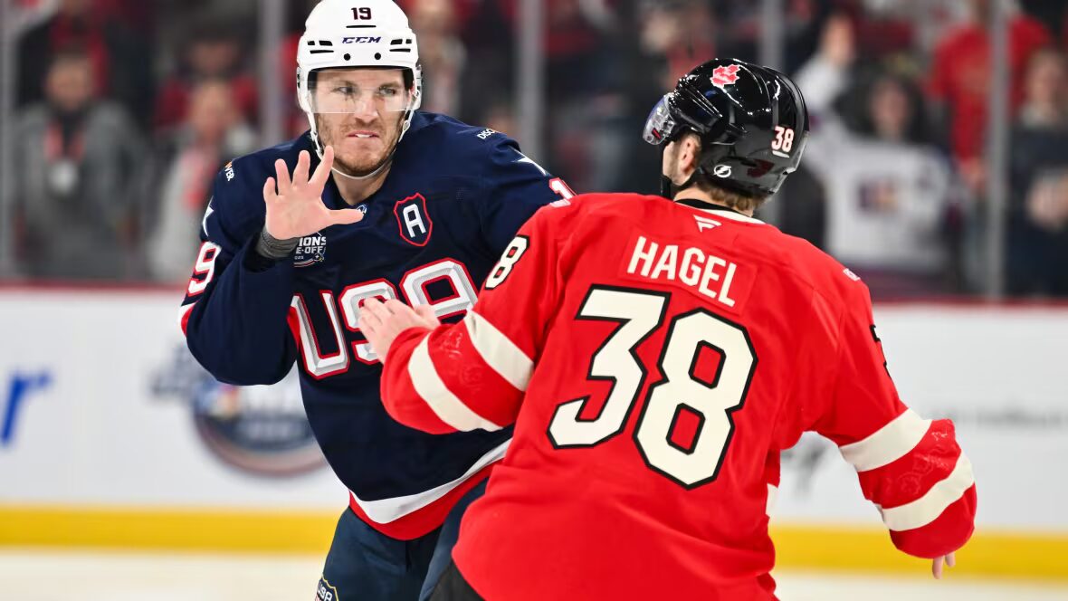 Américains - Retour des Américains blessés : 4 Nations Notes