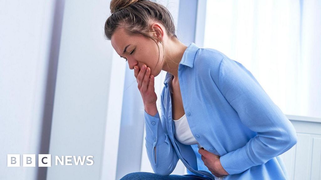 norovirus - Les cas d'hôpital liés au norovirus atteignent un niveau record