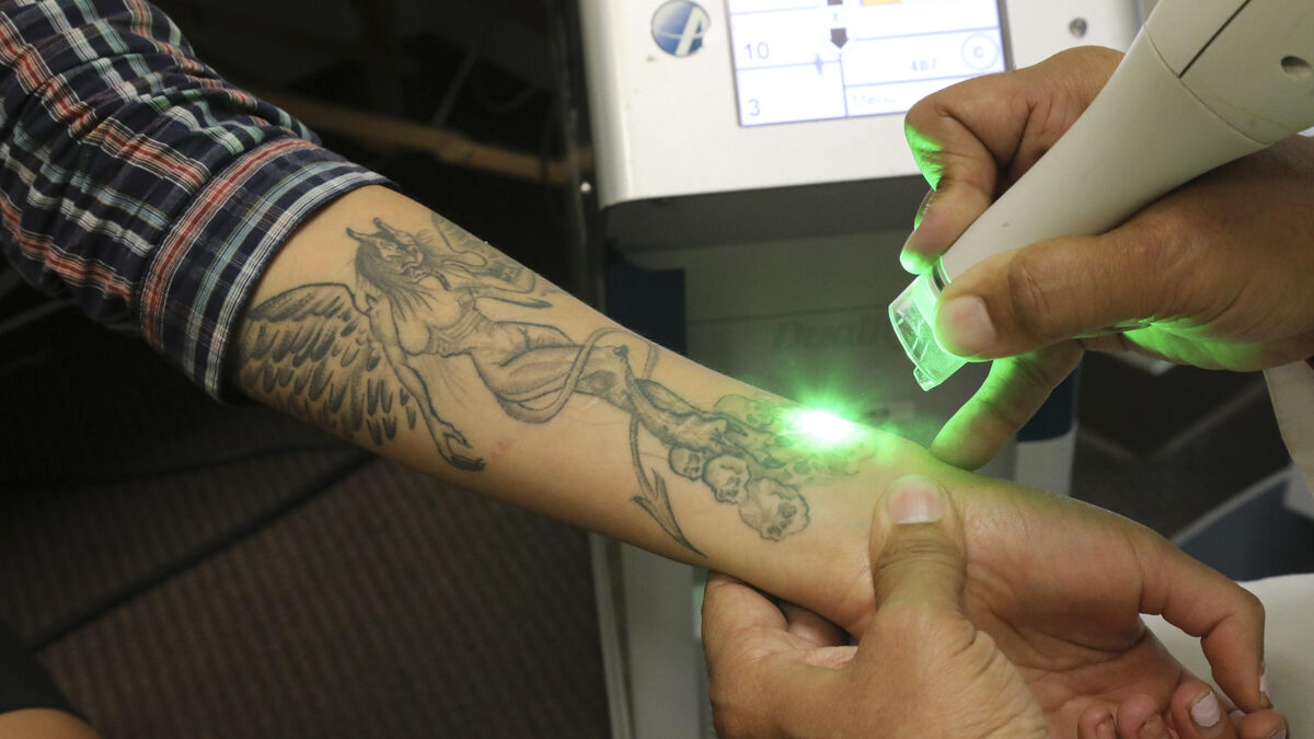 Tatouages - Les Musulmans Indonésiens Invités à Se Faire Retirer Gratuitement Leurs Tatouages Pendant Le Ramadan