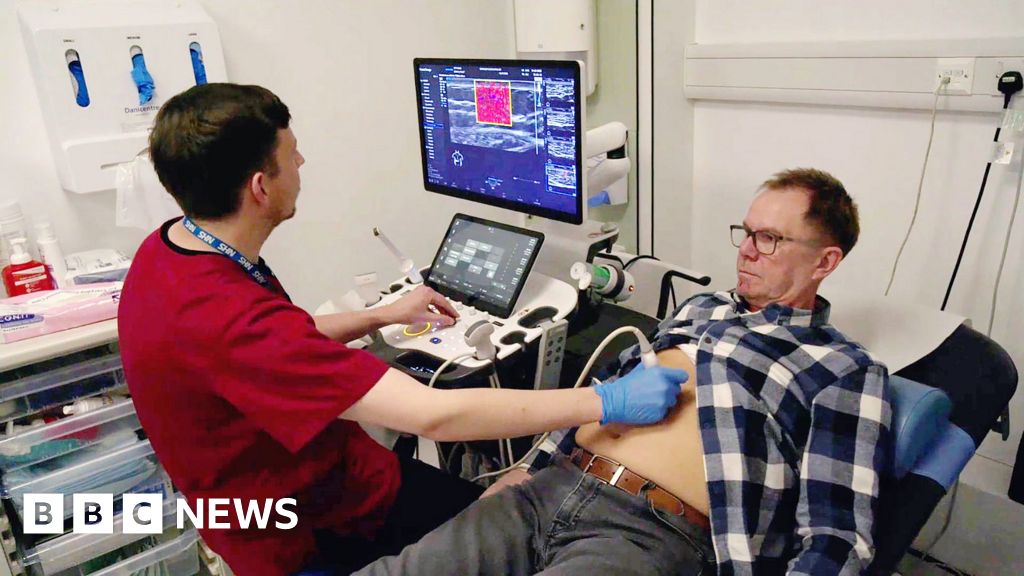 Scanners - Scanners dans les centres commerciaux et IA : ces idées peuvent-elles aider à sauver le NHS ?