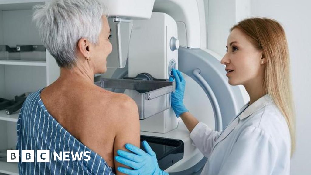 dépistages - Appel pour que le NHS offre des dépistages supplémentaires du cancer aux femmes ayant des seins denses