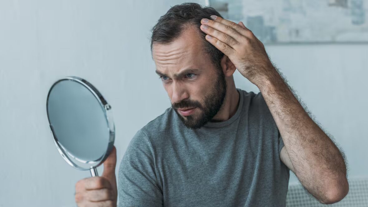 médicament - Les autorités sanitaires mettent en garde contre les risques graves potentiels du médicament contre la perte de cheveux
