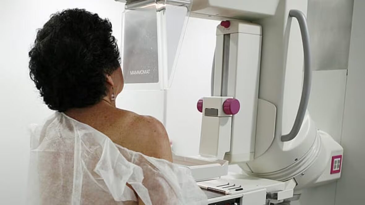 cancer - Réforme majeure ordonnée pour le groupe qui établit les lignes directrices sur le dépistage du cancer au Canada