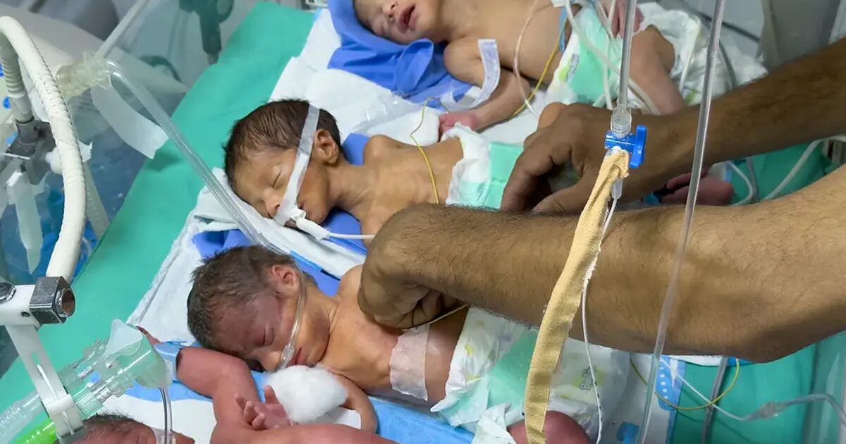 enfant - Un autre enfant meurt de dénutrition à Gaza, le quatrième en 48 heures