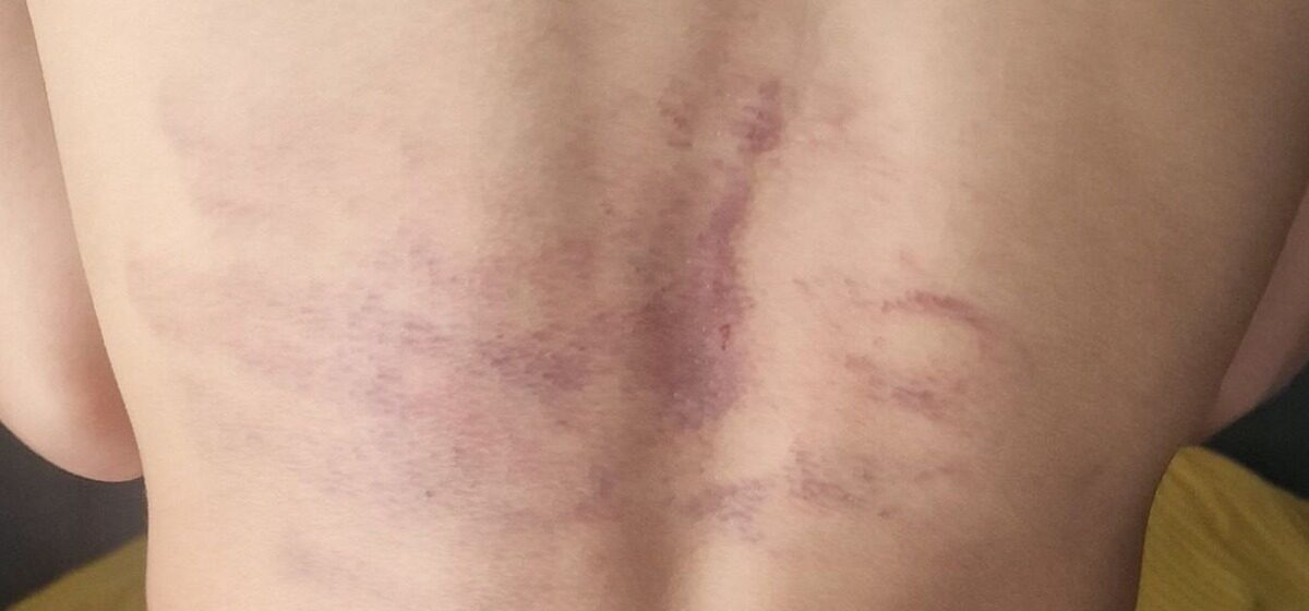 footballeurs - Coups de barre de fer, câbles, claques… Le séjour cauchemardesque de jeunes footballeurs de Clichy en Espagne