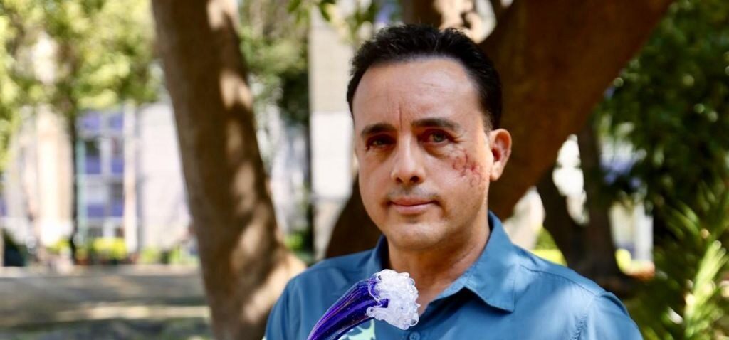 requin - « Cet animal a sauvé ma vie » : Un biologiste mordu à la tête par un requin espère le retrouver