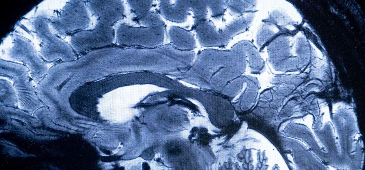 Cerveau - « Un Organe Vivant » : Les Secrets d’un Neuroscientifique pour Maintenir un Cerveau en « bonne Santé » Jusqu’à 90 Ans