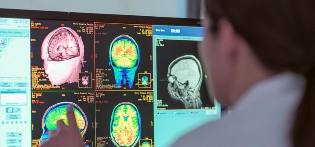 étude - L'adolescence s'étend jusqu'à 30 ans : une nouvelle étude révèle quatre âges clés pour votre cerveau