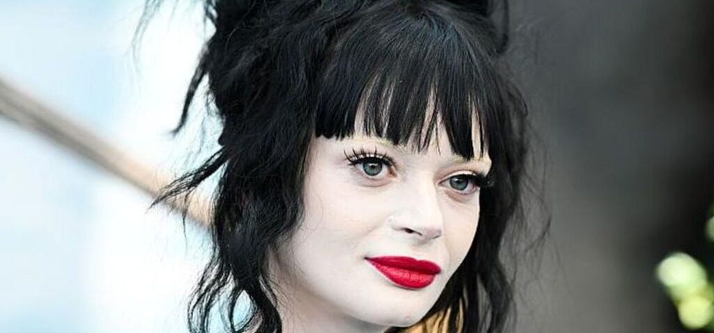 star - Ruth Codd, la star de Celebrity Traitors, se remet après une seconde amputation de la jambe