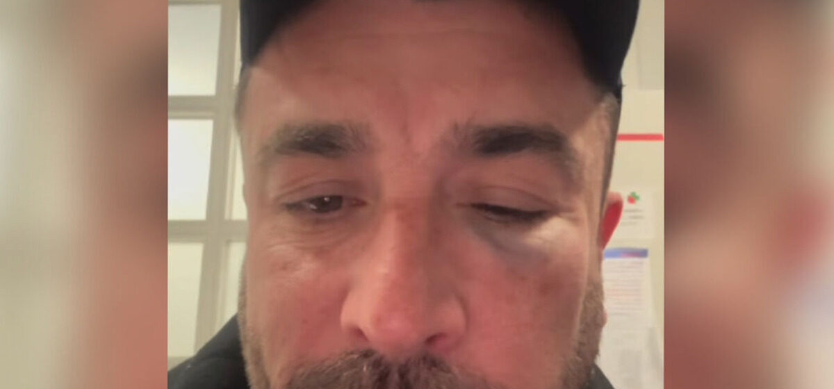 humoriste - L’humoriste Anthony Joubert agressé dans un train avant son spectacle dans l'Oise