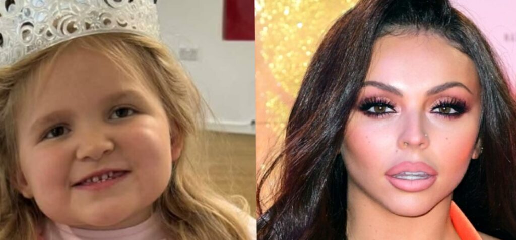 diagnostic - Nos enfants ont trop attendu le même diagnostic que celui des jumeaux de Jesy Nelson