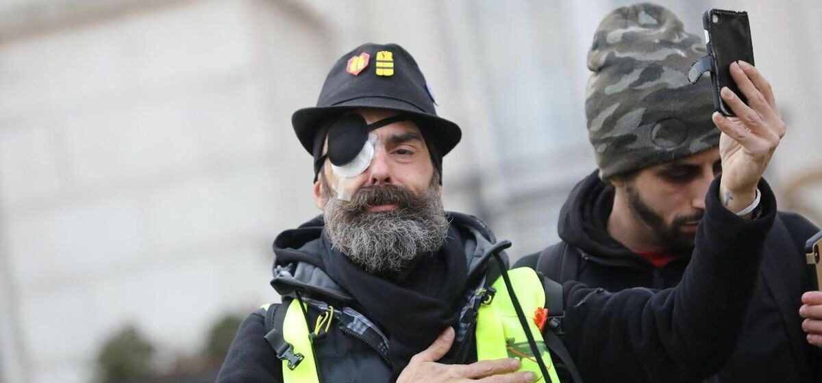 Jérôme - « Sept Ans Que J’attends » : Le policier suspecté d’avoir éborgné le gilet jaune Jérôme Rodrigues sera enfin jugé